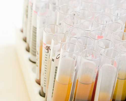 子宫切除 怀孕吗_子宫切除 怀孕,嘉兴哪家医院对卵巢早衰调理、试管婴儿更有